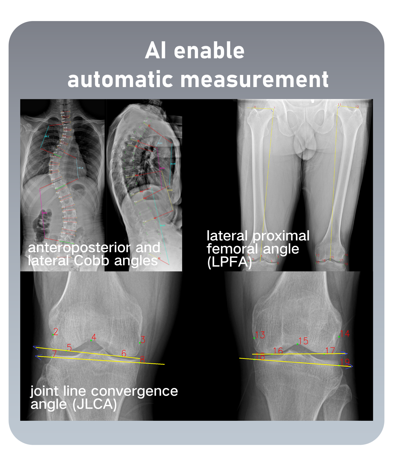 美的医疗携AI影像成果亮相RSNA，海外生态稳步拓展 智能公会
