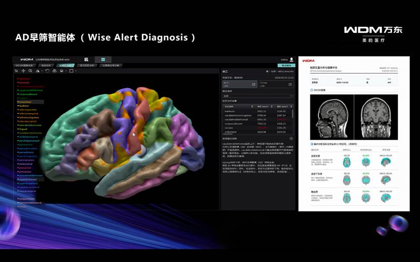 用本土数据训练“中国智能体”：万东医疗让AI真正懂中国临床 智能公会